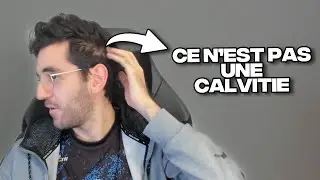 NON, JE N'AI PAS DE CALVITIE