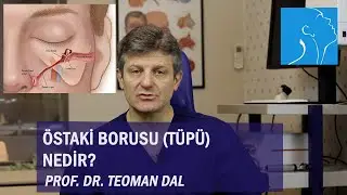 ÖSTAKİ BORUSU (TÜPÜ) NEDİR? | PROF. DR. TEOMAN DAL