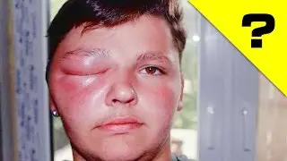ЧЕЙ ЭТО УКУС?