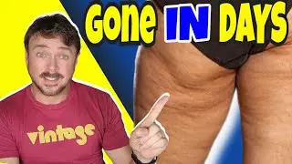 Erase Cellulite In Just Days | Natural Oil Treatments | Chris Gibson