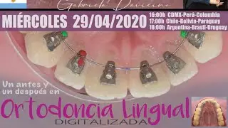 CONVERSATORIO 29 | Ortodoncia Lingual Digitalizada | Gabriela Davicino