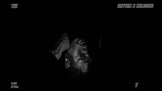 TEE - FVLA