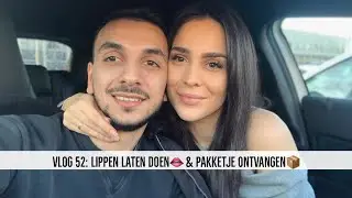 VLOG 52 : LIPPEN LATEN DOEN 👄 & PAKKETJE ONTVANGEN 📦