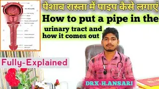 How To Apply Foley Catheter | Stop Urine Discharge Solution