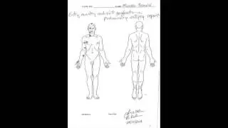 Will There Be Justice!! Autopsy Shows Unarmed Black Teen Mike Brown Was Shot At Least 6 Times By Fer