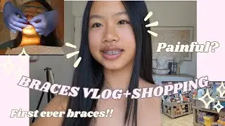 Getting BRACES VLOG+Shopping!!🛍|Braces|shopping|Food ETC!!