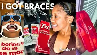 I GOT BRACES... for the first time! This happened..