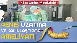 Penis  Uzatma ve Kalınlaştırma Ameliyatı (+3 cm Uzunluk, +4 cm Kalınlık )
