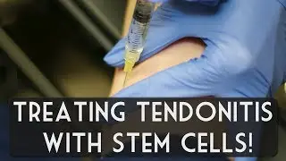 PRP (Platelet Rich Plasma) How athletes are using it to help accelerate healing