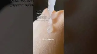 Как начать использовать ниацинамид? Арт: 154859673 , 142054898 , 154859676 #бьюти #прыщи