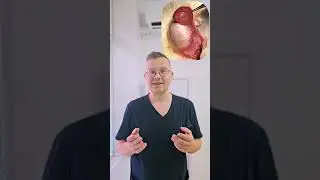 Третье яичко