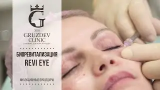 Как убрать морщины вокруг глаз
