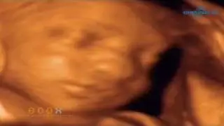 Cuándo puedo ver a mi hijo antes de nacer