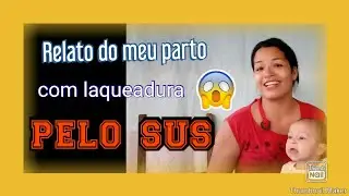 Relato do meu parto com laqueadura pelo sus eu quase morri