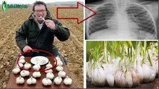 Хар куни Оч Қоринга Чеснок  Есангиз Мўъжизани Кўрасиз