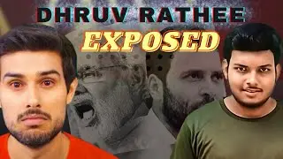 Dhruve rathee Roast🔥||Roast video||Ashish Singh Rajput||ASR
