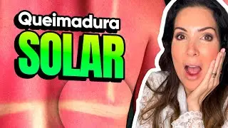 Queimadura de sol - nunca mais!!!