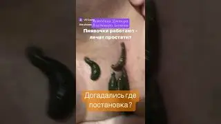 Простатит лечим пиявками