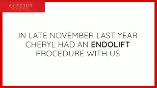 🇬🇧 Cheryl's testify about Endolift® | non-surgical laser lifting for skin laxity [Eufoton®]