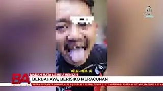 MAKAN MATA LEMBU MENTAH BERBAHAYA, BERISIKO KERACUNAN