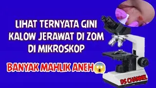 EXPERIMENT ZOM JERAWAT 1000X DI MIKROSKOP