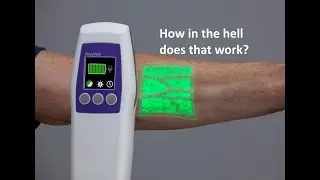 How in the hell? Laser Vein Finders