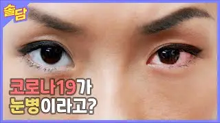 코로나19가 눈병으로 돌아왔다?