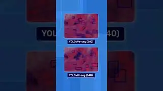 Instance Segmentation for Medical Imaging: YOLOv8 vs YOLOv9