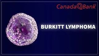 Burkitt Lymphoma: Symptoms, Diagnosis, Types & Treatment | High-Yield Hematology | CanadaQBank