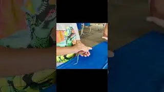 A SNAKE bit me!