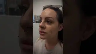 Healed dimple piercing & fresh nose piercing by 