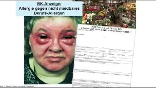 Berufsdermatologie Teil 2 BK 5101, Hautarztbericht