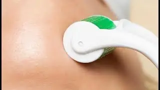Sdara Skincare Derma Roller Microneedling Roller for Face, Includes Free Storage Case Review
