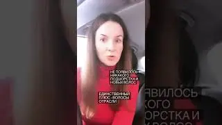 Выпали волосы после коронавируса: как восстанавливаю