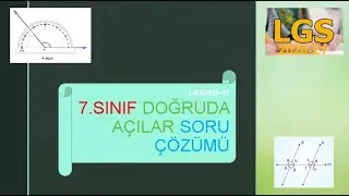 7.SINIF MATEMATİK DOĞRUDA AÇILAR | SORU ÇÖZÜMÜ 