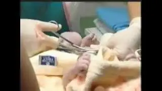 Video Training Dasar-Dasar Persalinan (Childbirth Basics)