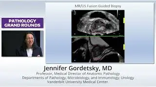Established and Emerging Prognostic Markers in Prostate Pathology