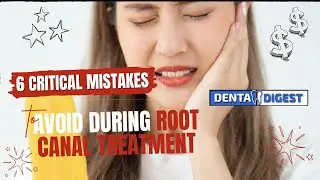 6 Critical mistakes to avoid during Root canal treatment