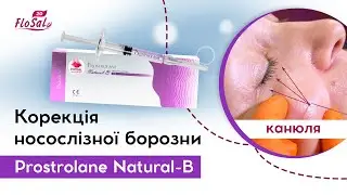 Безпечна корекція носослізної борозни препаратом Prostrolane Natural-B