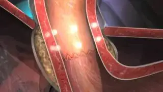STRETTA ANIMATION