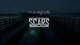 CHRYS THOMPSON - SCARS (Lyric Video)