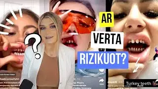 Turkijos šypsena🦷