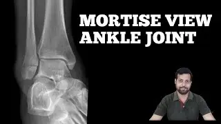 HOW TO DO MORTISE VIEW. #anatomy #xrayclasses #mortise