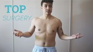 FINALLY SHIRTLESS // FTM
