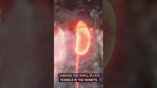 How does diabetes contribute to complications such as kidney disease? #shorts