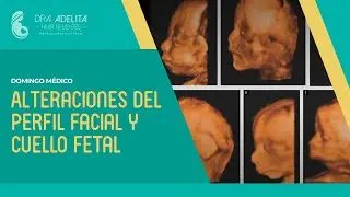 Alteraciones del perfil facial y cuello fetal 2023 - Congreso Centroamericano FECASOG 2023