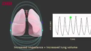 DSI Respiratory Impedance Telemetry Device