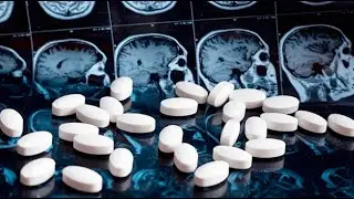 Immunotherapy for Alzheimer’s disease shows promise