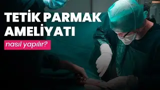 Tetik Parmak Ameliyatı Izle