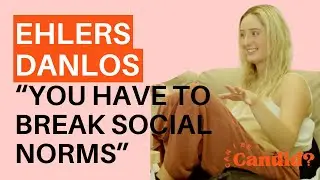 Histamine is Linked with Ehlers Danlos Syndrome | How To Manage Ehlers-Danlos Syndrome, MCAS & PoTS.
